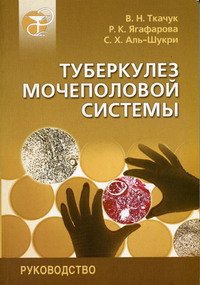 Туберкулез мочеполовой системы